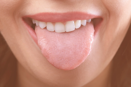 Tongue